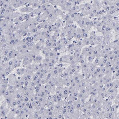 Immunohistochemistry-Paraffin: Thyroglobulin Antibody [NBP1-90200] - Staining of human liver shows no positivity in hepatocytes as expected.