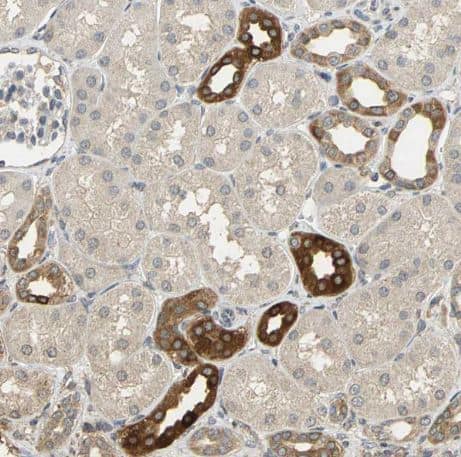 Staining of human kidney shows strong cytoplasmic positivity in subset of cells in tubules.