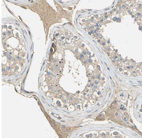 Staining of human testis shows moderate cytoplasmic positivity in Leydig cells.