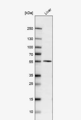 Western Blot: Dopa Decarboxylase/DDC Antibody [NBP1-90293] -Analysis in human liver tissue.