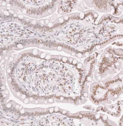 Immunohistochemistry-Paraffin Thyroid receptor-interacting protein 13 Antibody - BSA Free