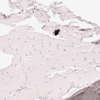 Immunohistochemistry-Paraffin Thyroid receptor-interacting protein 13 Antibody - BSA Free