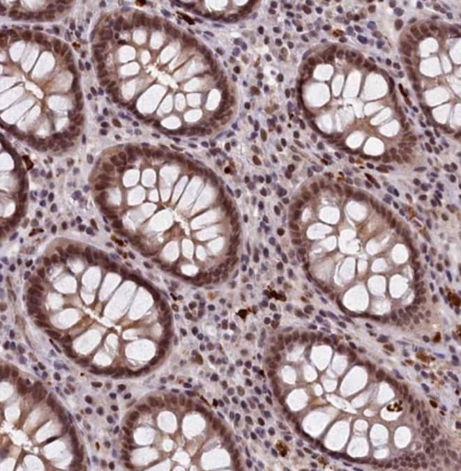 Staining of human colon shows moderate nuclear positivity in glandular cells and lymphoid cells.