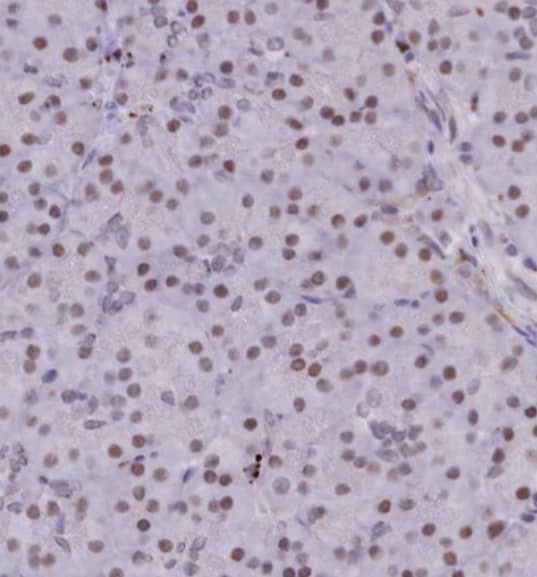 Staining of human pancreas shows moderate nuclear positivity in exocrine glandular cells.