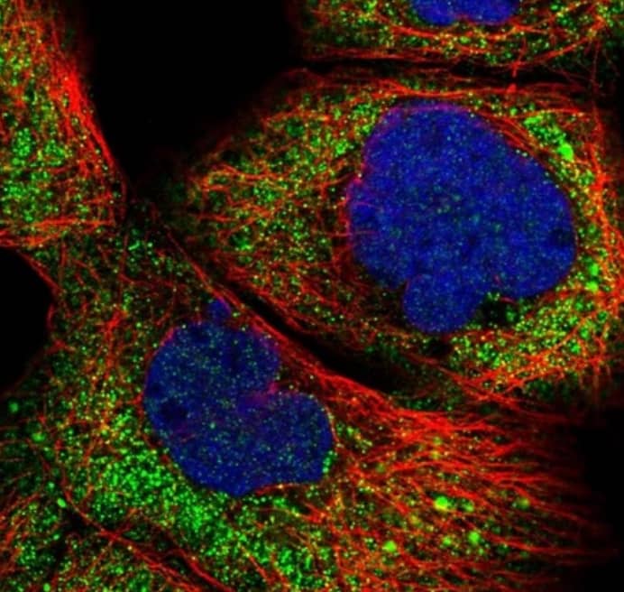  Staining of human cell line A-431 shows localization to cytosol.