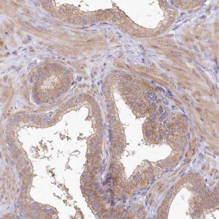 Immunohistochemistry-Paraffin: BIG3 Antibody [NBP1-90759] -Staining of human prostate shows moderate cytoplasmic/membranous positivity in glandular cells and smooth muscle cells.