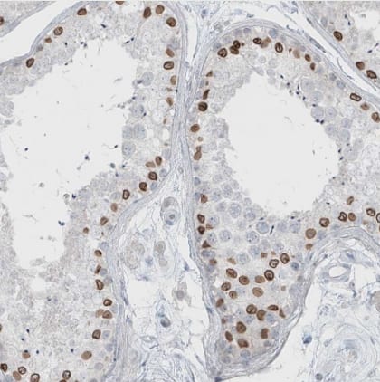 Immunohistochemistry-Paraffin PRDM6 Antibody - BSA Free