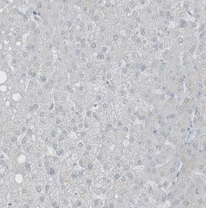 Immunohistochemistry-Paraffin: PRDM6 Antibody [NBP1-91022] -Staining of human liver shows no positivity in hepatocytes as expected.