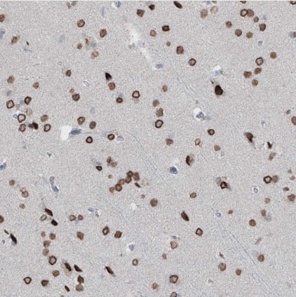 Immunohistochemistry-Paraffin PRDM6 Antibody - BSA Free