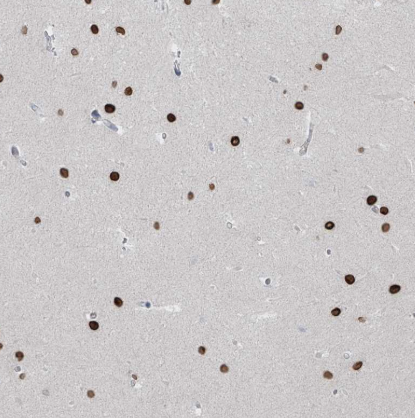 Immunohistochemistry-Paraffin PRDM6 Antibody - BSA Free