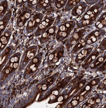 Immunohistochemistry-Paraffin: LIPT2 Antibody [NBP1-91135] - Staining of human duodenum shows strong granular cytoplasmic positivity in glandular cells. 