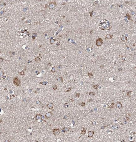 Immunohistochemistry-Paraffin: LIPT2 Antibody [NBP1-91135] - Staining of human cerebral cortex shows moderate granular cytoplasmic positivity in neurons.