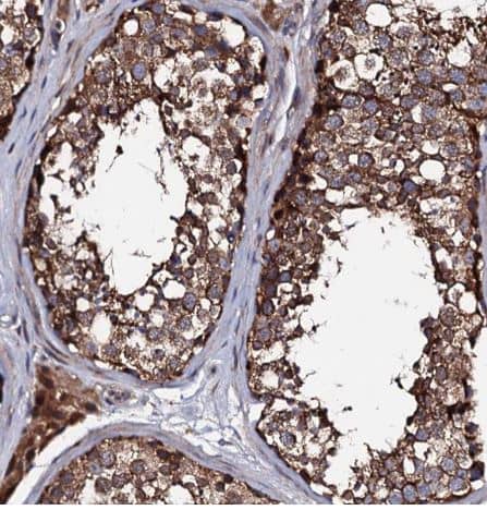 Immunohistochemistry-Paraffin: LIPT2 Antibody [NBP1-91135] - Staining of human testis shows strong granular cytoplasmic positivity in cells in seminiferous ducts.