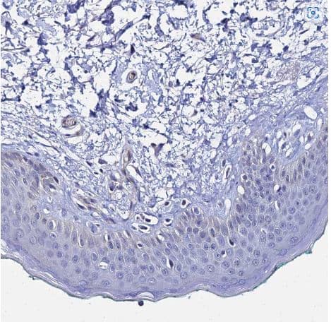 Immunohistochemistry-Paraffin: ARP10 Antibody [NBP1-91682] - Staining of human skin shows no positivity in squamous epithelial cells as expected.