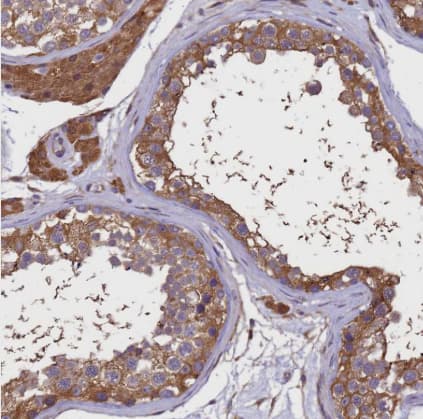 Immunohistochemistry-Paraffin GID4 Antibody