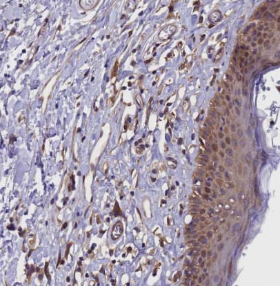 Immunohistochemistry-Paraffin GID4 Antibody