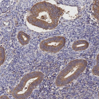 Immunohistochemistry-Paraffin GID4 Antibody