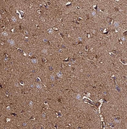 Immunohistochemistry-Paraffin: C2orf69 Antibody [NBP1-91731] -  Staining of human cerebral cortex shows moderate cytoplasmic positivity in neuropil.