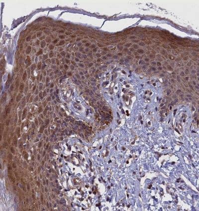Immunohistochemistry-Paraffin: COMMD2 Antibody [NBP1-91802] -Staining of human skin shows strong cytoplasmic positivity in squamous epithelial cells.