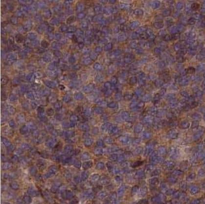 Immunohistochemistry-Paraffin: COMMD2 Antibody [NBP1-91802] -Staining of human tonsil shows moderate cytoplasmic positivity in non-germinal center cells.