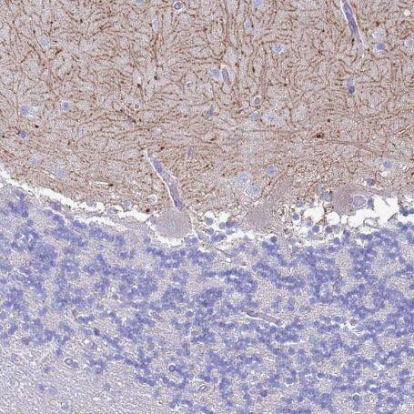 Immunohistochemistry-Paraffin: FAM108B1 Antibody [NBP1-91878] -  Staining of human cerebellum shows strong positivity in neuronal processes in cells in molecular layer.