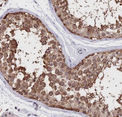 Immunohistochemistry-Paraffin INPP4A Antibody - BSA Free