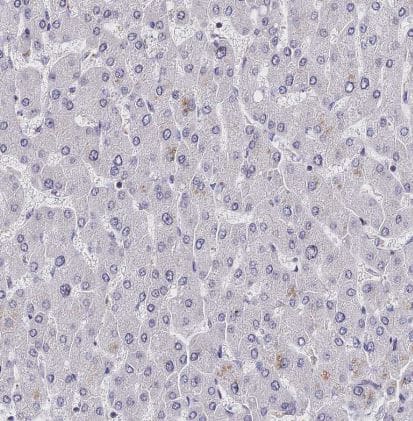 Immunohistochemistry-Paraffin INPP4A Antibody - BSA Free