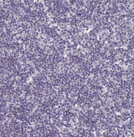 Immunohistochemistry-Paraffin: LOC81691 exonuclease NEF-sp Antibody [NBP1-92075] - Staining of human lymph node shows no positivity in non-germinal center cells as expected.