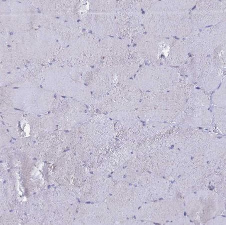 Immunohistochemistry-Paraffin: LOC81691 exonuclease NEF-sp Antibody [NBP1-92075] - Staining of human skeletal muscle shows no positivity in myocytes as expected.