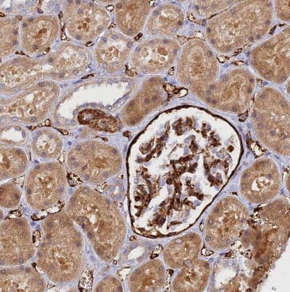 Immunohistochemistry-Paraffin Myosin IXA Antibody