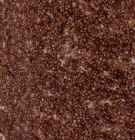 Staining of human lymphoid tissues shows strong cytoplasmic membranous positivity in non-germinal center cells and germinal center cells.