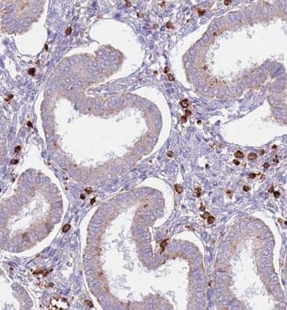 TTPAL- Antibody-  NBP1-92544 -IHC-P-Staining of human endometrium shows strong cytoplasmic positivity in stromal cells.