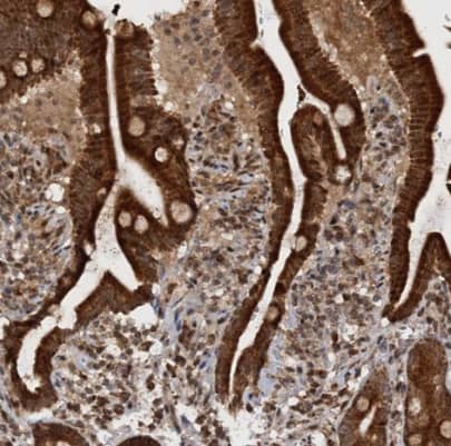 Immunohistochemistry-Paraffin: REP15 Antibody [NBP1-93441] -Staining of human duodenum shows strong cytoplasmic positivity in glandular cells.