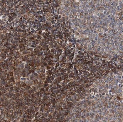 Immunohistochemistry-Paraffin: TMEM109 Antibody [NBP1-93462] - Staining of human tonsil shows strong cytoplasmic positivity in non-germinal center cells.