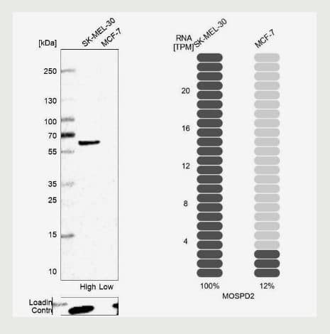 Western Blot-MOSPD2 Antibody [NBP1-93499] -  Analysis in human cell lines SK-MEL-30 and MCF-7 using Anti-MOSPD2 antibody. Corresponding MOSPD2 RNA-seq data are presented for the same cell lines. Loading control: Anti-PFN1.
