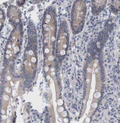 Immunohistochemistry-Paraffin: FAM83H Antibody [NBP1-93737] - Staining of human duodenum shows weak cytoplasmic positivity in glandular cells.