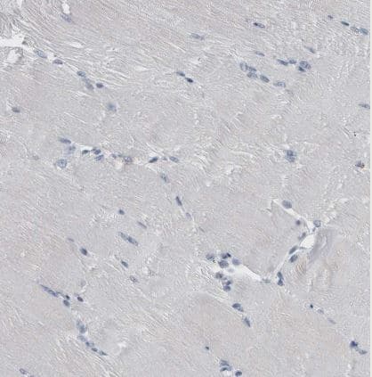 Immunohistochemistry-Paraffin: FAM83H Antibody [NBP1-93737] - Staining of human skeletal muscle shows no positivity in myocytes as expected.