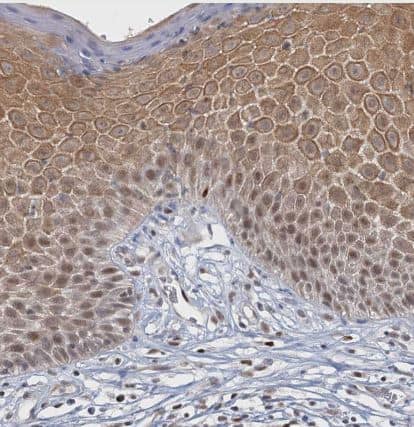 Immunohistochemistry-Paraffin: CCDC75 Antibody [NBP1-93801] -Staining of human skin shows moderate nuclear and cytoplasmic positivity in squamous epithelial cells.