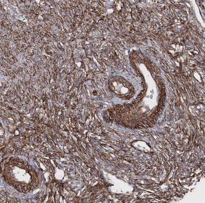 Immunohistochemistry-Paraffin: TMEM164 Antibody [NBP1-93939] -Staining of human Ovary shows strong membranous positivity in follicle and stromal cells.