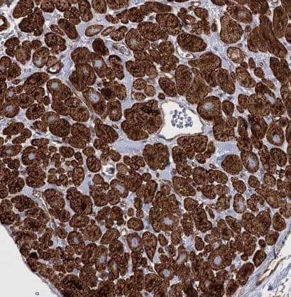 Immunohistochemistry-Paraffin: TMEM164 Antibody [NBP1-93939] -Staining of human Heart muscle shows strong cytoplasmic and membranous positivity in cardiomyocytes.