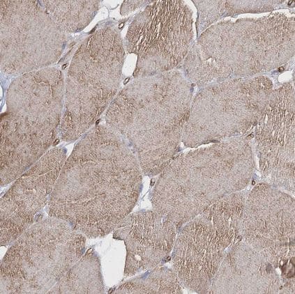 Immunohistochemistry-Paraffin: TMEM164 Antibody [NBP1-93939] - Staining of human Skeletal muscle shows moderate cytoplasmic positivity in myocytes.