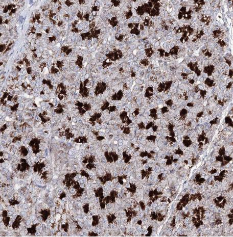 Immunohistochemistry-Paraffin: TOP6BL Antibody [NBP1-93944] -Staining of human pancreas shows strong cytoplasmic positivity in exocrine glandular cells.