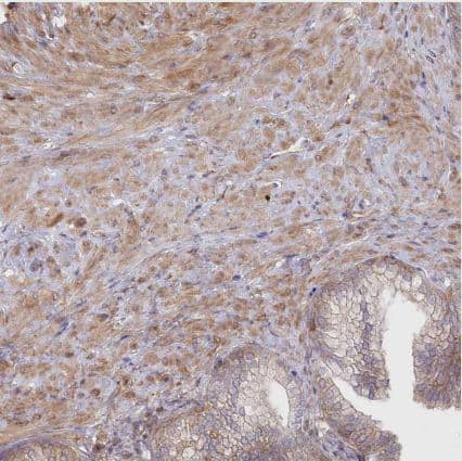 Immunohistochemistry-Paraffin: SH3PXD2B Antibody [NBP1-93965] - Staining of human prostate shows moderate cytoplasmic positivity in smooth muscle cells.
