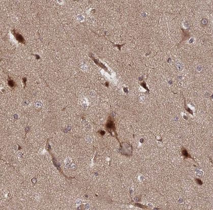Immunohistochemistry-Paraffin: INO80D Antibody [NBP1-93981] -Staining of human cerebral cortex shows strong nuclear positivity in neurons.