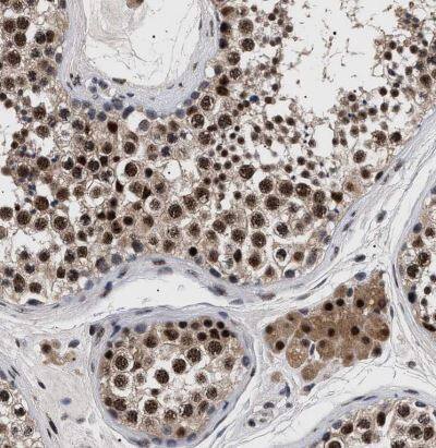 Immunohistochemistry-Paraffin: CAAP1 Antibody [NBP1-94018] -Staining of human testis shows moderate nuclear positivity in cells in seminiferous ducts.