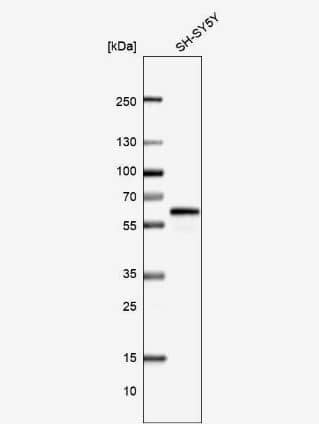 Western Blot: CAAP1 Antibody [NBP1-94018] - Analysis in human cell line SH-SY5Y.