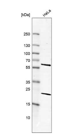 Analysis in human cell line HeLa.