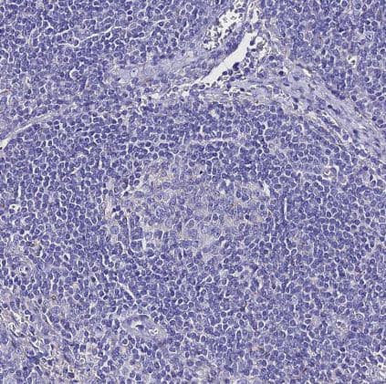 Immunohistochemistry-Paraffin: TMEM117 Antibody [NBP1-94078] - Staining of human lymph node shows no positivity in non-germinal center cells as expected.