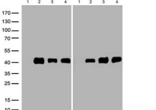 Analysis of overexpressedlysates (25ug per lane) from HEK293T cellstransfected with empty plasmid, lane1) , human LPAR1 plasmid ,lane 2),mouse LPAR1 plasmid ([MR205601], lane 3), ratLPAR1 plasmid,  lane 4) using antiLPAR1 antibody (1:500). Figure B,Western blot analysis of the same samples asfigure A with anti-DDK antibody,1:1000)