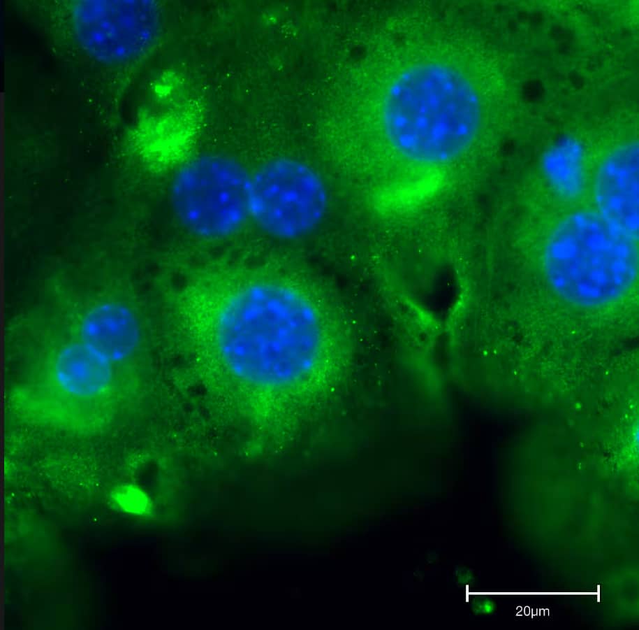 Immunocytochemistry/Immunofluorescence: Mouse ERp72 mAb (OTI2B9) [NBP2-01652] - Primary mouse hepatocytes stained with ERp72 mAb. Image from a verified customer review.